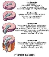 Rysunek poglądowy