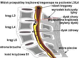 Rysunek poglądowy